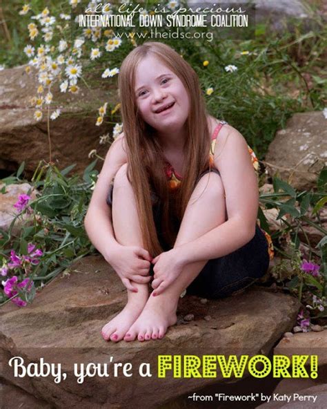 887 Best Down Syndrome Images On Pinterest Down Syndrome