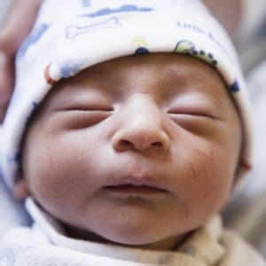 newborn normals kids  pediatrics