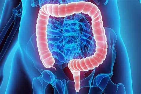 colon cancer symptoms causes diagnosis and treatment
