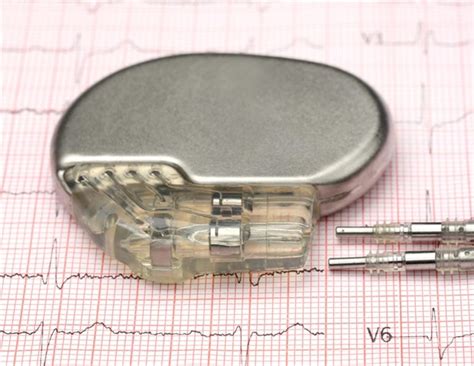 type  bionic pacemaker
