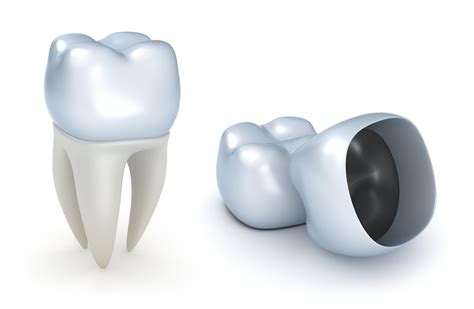 dental crowns    highly beneficial form  cosmetic dentistry