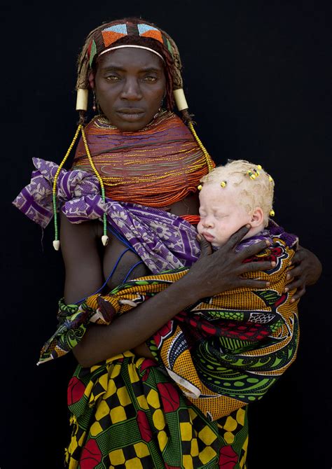 albino baby girl   mwila mother angola  mwila flickr