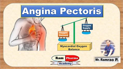 angina pectoris sign symptoms  types youtube