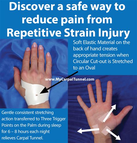 repetitive strain injury rsi carpal tunnel syndrome relief