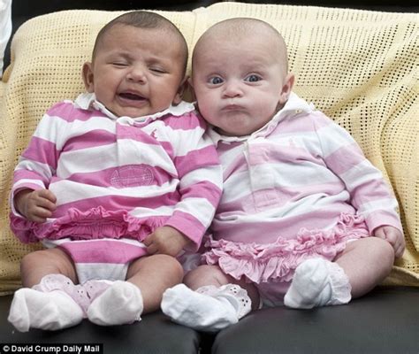 One In A Million Twins Born With Different Skin Colors Photos
