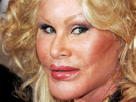 donatella versace celebrity plastic surgery disasters pictures
