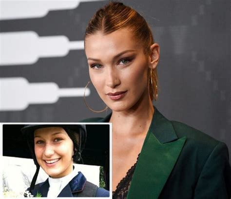 bella hadid busted old pictures of her prove that she had plastic