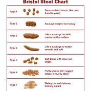 bristol stool chart scale mug spreadshirt