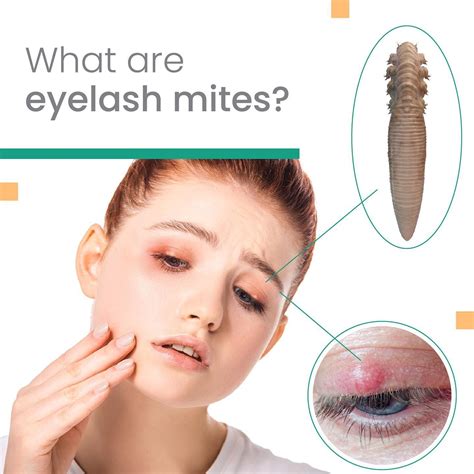 eyelash mites    types  demodex mites called
