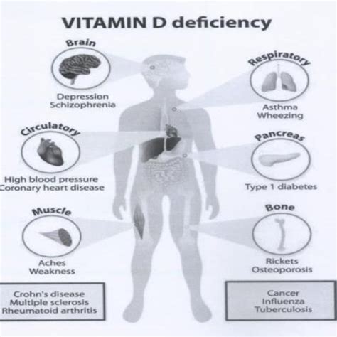 Pdf Vitamin D Deficiency In Non Skeletal Diseases More Than Just A