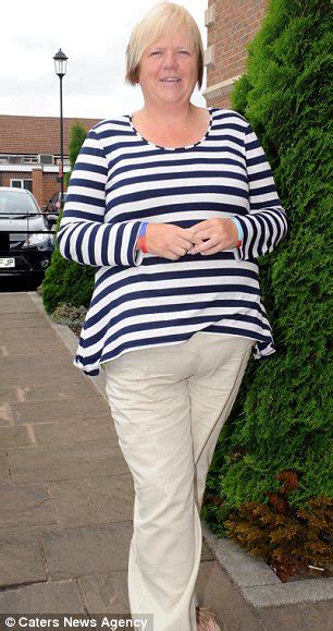 Gastric Sleeve 27 Stone Grandmother Loses Nearly Half Her Body Weight