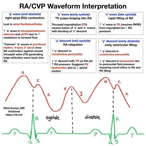 racvp waveform interpretation central venous pressure grepmed