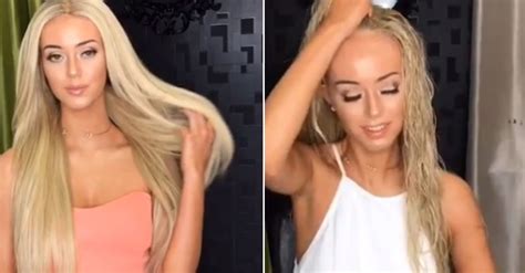 model takes off her wig on camera to reveal her alopecia diagnosis for the first time