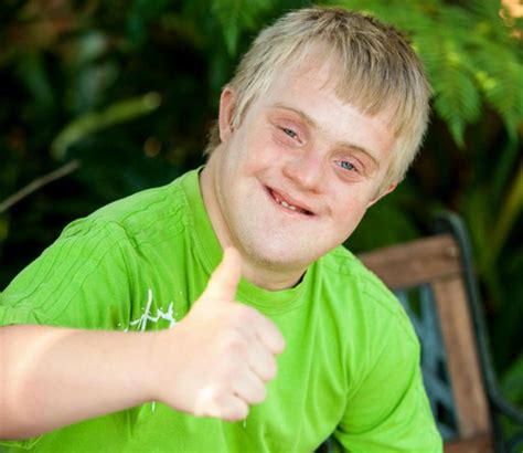 What Is Mosaic Down Syndrome Symptoms Pictures