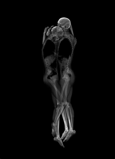 Intimate X Ray Portraits Of Cuddling Couples