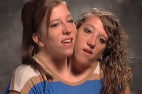 World Famous Conjoined Twins Defy Fears By Learning To Drive And Going
