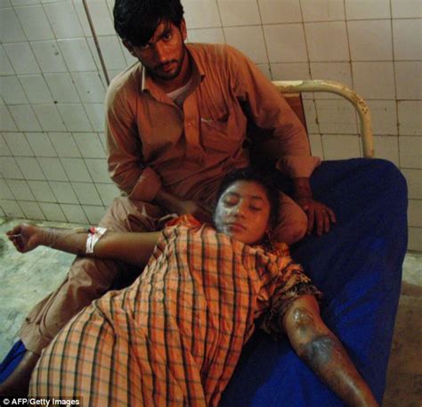 Bushra Waiz 18 Critically Injured After Attacker Hurls Acid In Her