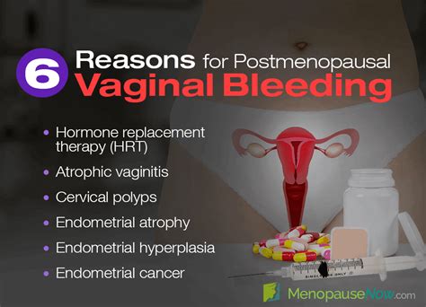 6 reasons for postmenopausal vaginal bleeding