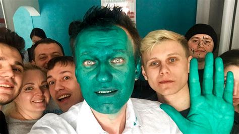 anti putin activist alexei navalny sprayed green in attack fox news