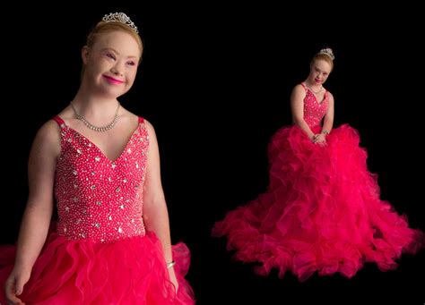 a teen with down syndrome just landed a modelling contract