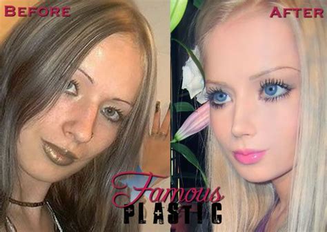 1000 images about real life barbie on pinterest image search barbie dolls and plastic surgery