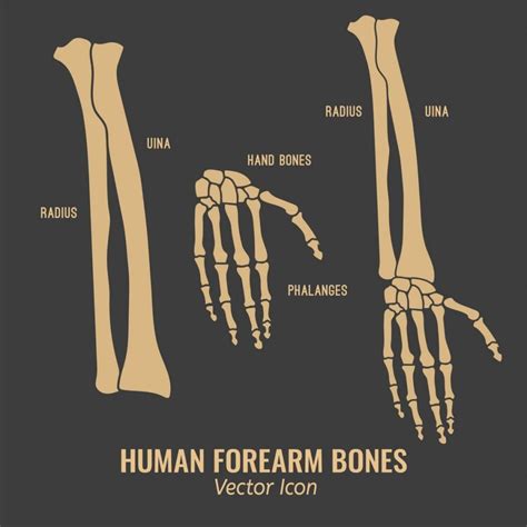 bones   arms facty health