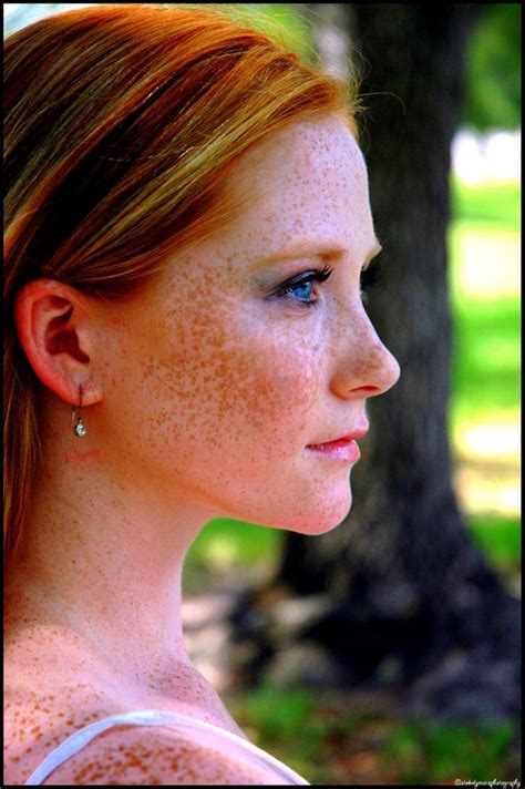 Amazing Redheads Beautiful Freckles Freckles Girl Beautiful Red Hair