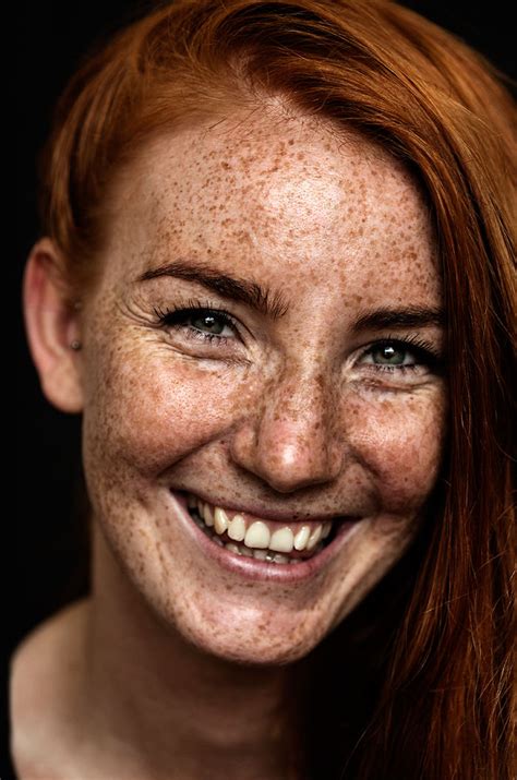 98 Freckled People Who Ll Hypnotize You With Their Unique Beauty