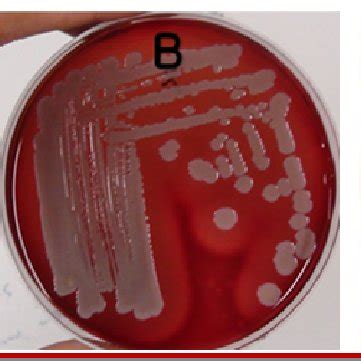 hemolytic phenomenon test  test strain lactobacillus plantarum