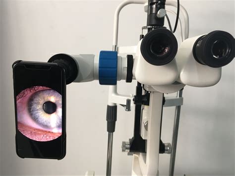 smartphone video adapter  surgery video recordingnew vision meditec