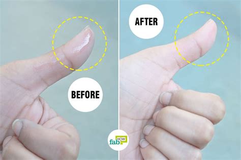 remove super glue  skin  methods  work fab