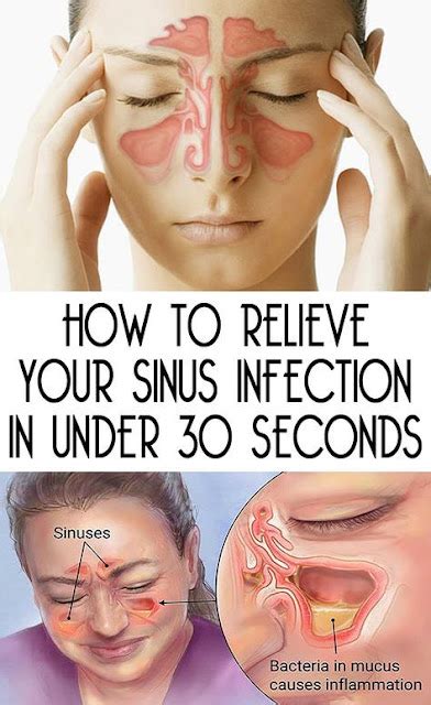 therapist explains   clear  sinuses immediately