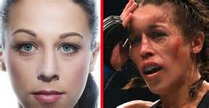 The Face Of Ufc Fighter Joanna Jedrzejczyk Before And