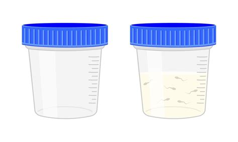 semen analysis sperm sample plastic container empty and full isolated