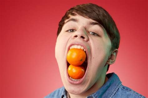 Teen Breaks His Own Record With 4 014 Inch Mouth Gape
