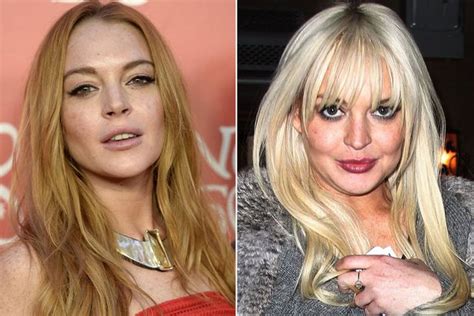 celebrities are shunning botox and plastic surgery in