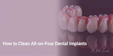 clean    dental implants