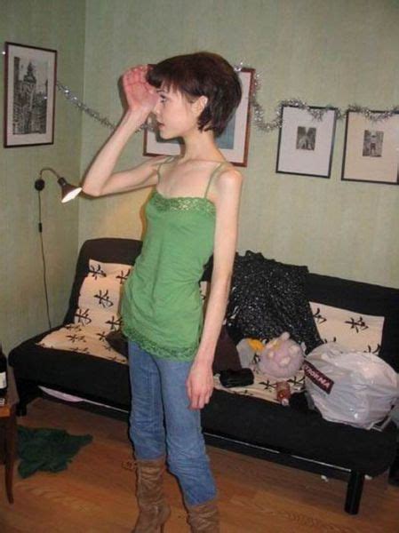 anorexic girls ~ damn cool pictures
