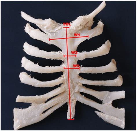 sexual dimorphism based   sternum bone morphometry  human