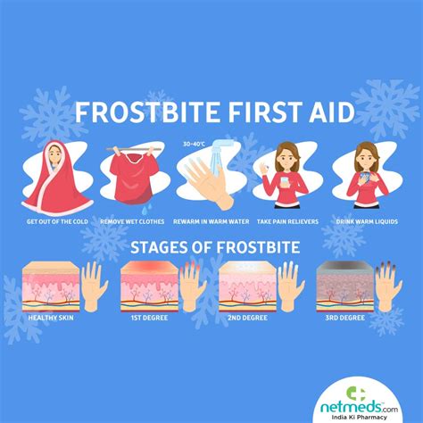 frost bite  symptoms  treatment netmeds