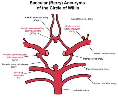 berry aneurysm  signs symptoms diagnosis treatment prognosis