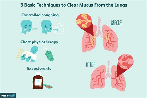 comment traiter laugmentation du mucus dans les poumons fmedic