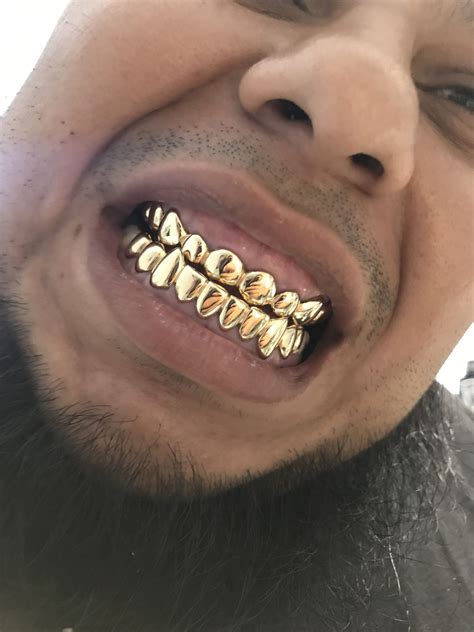 mouth full  gold palm beach jewelry jewelry design gold teeth