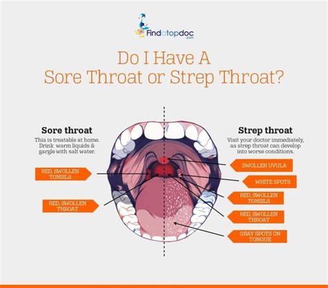 is it a sore throat or strep throat [infographic]