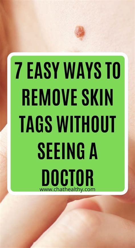 7 easy ways to remove skin tags without seeing a doctor in 2020 skin