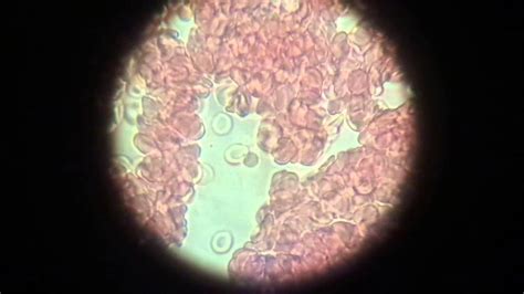 Biologia Celular Sangre En El Microscopio Youtube