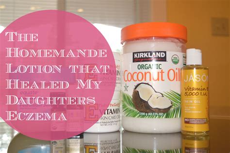 homemade lotion  healed  daughters eczema mommys dressing room