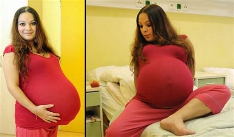 la verdad detrás de la historia de la mujer que estuvo “embarazada” por