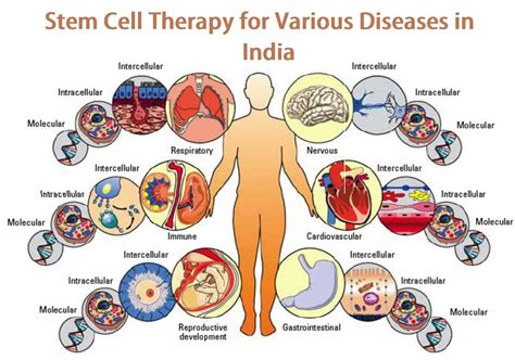 stem cell therapy   diseases  india  tourindiahealth