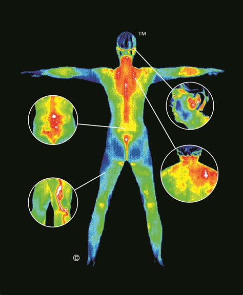 maintaining  health  thermography natural awakenings naples  fort myers
